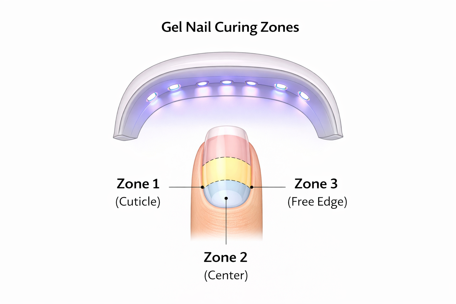 Gel curing zones